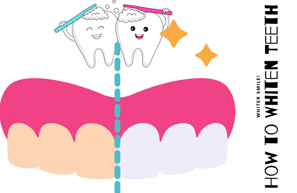 an illustration of How to Whiten Teeth