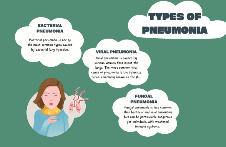 What is Pneumonia - Understanding and Effective Treatment 2023